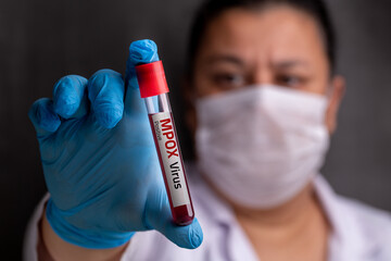 New Mpox Outbreak In Africa Leads To Cases In The U.S.