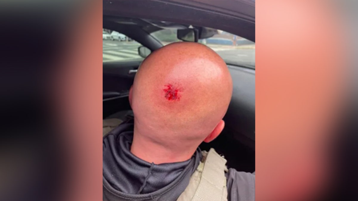 Back of head with visible bloody wound