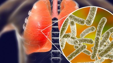 Two Die In Legionnaires Outbreak