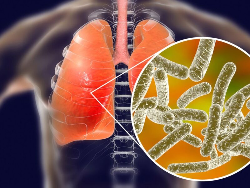 Two Die In Legionnaires Outbreak